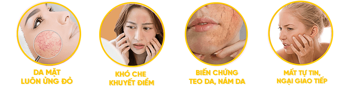 Hậu quả của giãn mao mạch