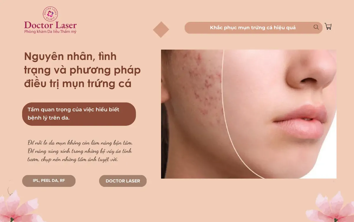 Nguyên nhân, tình trạng và phương pháp điều trị mụn trứng cá.